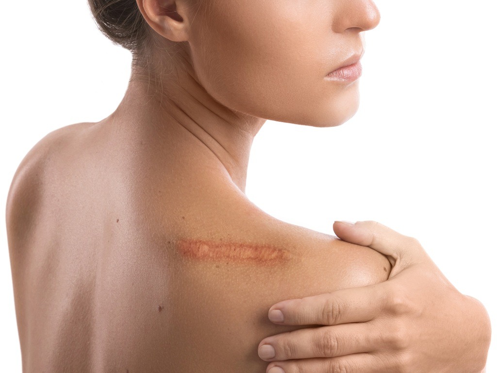Effective Treatment of Skin Problems with Safe Laser